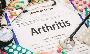 does calcium help with arthritis